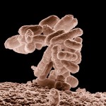 E. Coli @ 10000x